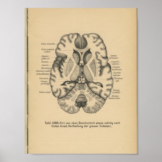 1888 Duits Anatomy Print Brain (Voorkant)