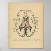  1888 Duits Anatomy Print Brain (Voorkant)
