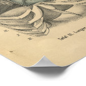  1888 Duits Anatomy Print Heart (Hoek)