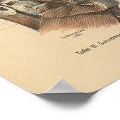  1888 Duitse anatomie drukspieren Poster (Hoek)