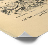  1888 Duitse anatomie Print Skull Eyes (Hoek)