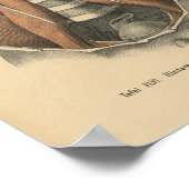  1888 Duitse Anatomy Print Abdomen (Hoek)