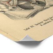 1888 Duitse Anatomy Print Abdomen (Hoek)