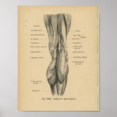  1888 Duitse Anatomy Print Beenknie (Voorkant)