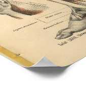  1888 Duitse Anatomy Print Boot Foot (Hoek)