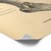  1888 Duitse Anatomy Print Boot Foot (Hoek)