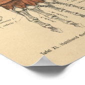  1888 Duitse Anatomy Print Hand Wrist (Hoek)