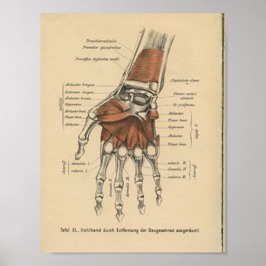  1888 Duitse Anatomy Print Hand Wrist (Voorkant)