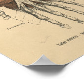  1888 Duitse Anatomy Print Hand Wrist (Hoek)