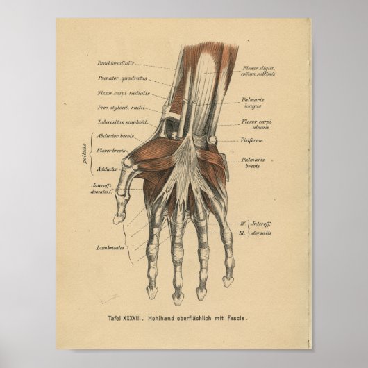  1888 Duitse Anatomy Print Hand Wrist (Voorkant)