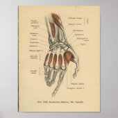  1888 Duitse Anatomy Print Hand Wrist (Voorkant)