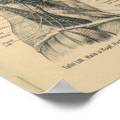  1888 Duitse anatomy Print Head Neck (Hoek)