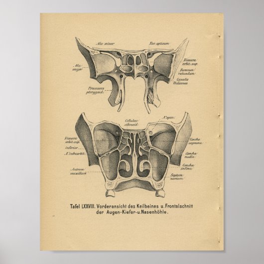  1888 Duitse Anatomy Print Sinuses (Voorkant)