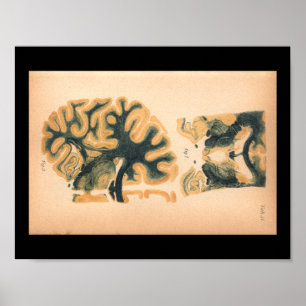 1901 hersenanatomie afdrukken poster