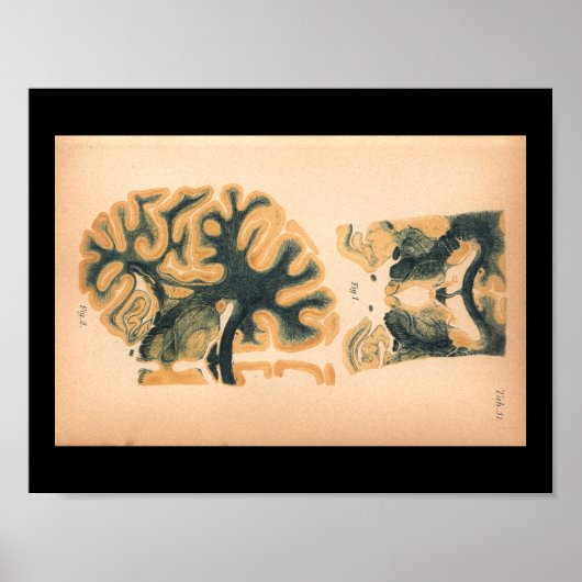  1901 hersenanatomie afdrukken poster (Voorkant)