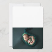 2 foto Baby Groene Dank u wel! Bedankkaart (Achterkant)