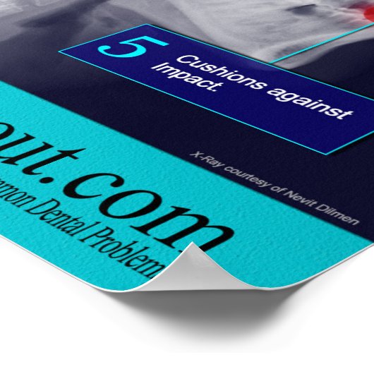 5 Redenen om een Mouthguard te Draag Poster (Hoek)