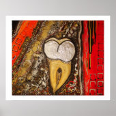 A014 Tandgevoeligheid Poster (Voorkant)