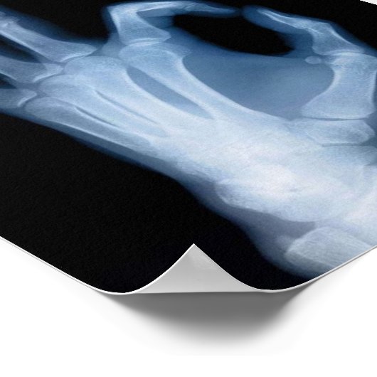 A-OK X-RAY POSTER (Hoek)