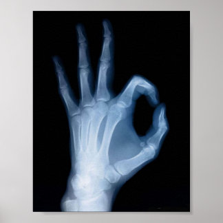 A-OK X-RAY POSTER