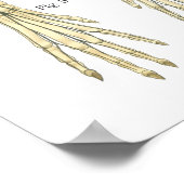 Aandoeningen van het zenuwstelsel Anatomie Poster (Hoek)