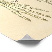 Aandoeningen van het zenuwstelsel poster (Hoek)