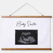 Aangepast Baby Sonogram Ultrasound Wood Onderworpe Hangend Wandkleed (Voorkant)