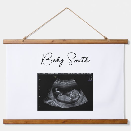 Aangepast Baby Sonogram Ultrasound Wood Onderworpe Hangend Wandkleed (Voorkant)