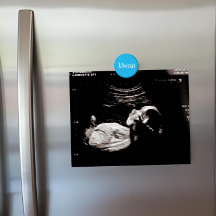 Aangepaste Azure Blauwe Naam Echografie Display Ko