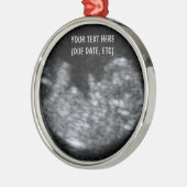 Aangepaste Baby echografie foto Metalen Ornament (Links)