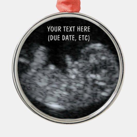 Aangepaste Baby echografie foto Metalen Ornament (Voorkant)