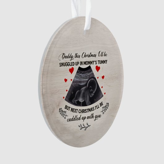 Aangepaste Baby Echografie Foto Ornament, Echograf Ornament (voorkant)