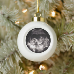 Aangepaste baby-echoscopie zwangerschapsaankondigi keramische bal ornament