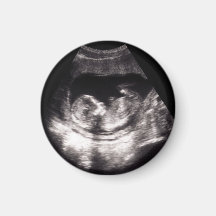 Aangepaste baby-echoscopie zwangerschapsaankondigi