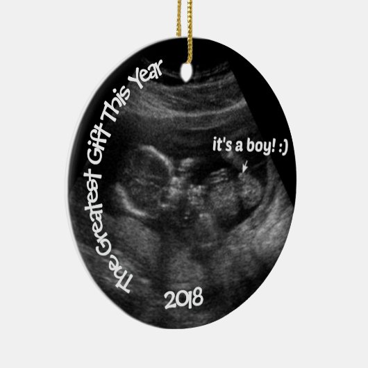 Aangepaste EASY Ultrasound Sjabloon Keramisch Ornament (Rechts)