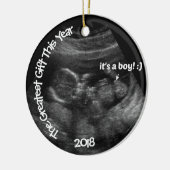 Aangepaste EASY Ultrasound Sjabloon Keramisch Ornament (Links)