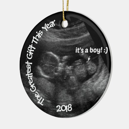 Aangepaste EASY Ultrasound Sjabloon Keramisch Ornament (Links)