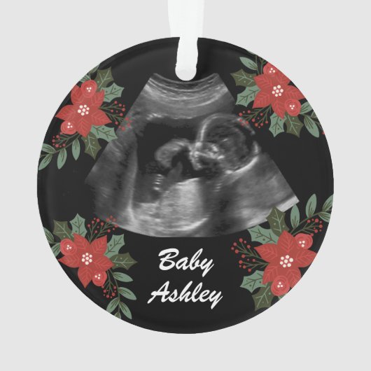 Aangepaste foto, echo sonogram kerst ornament (achterkant)