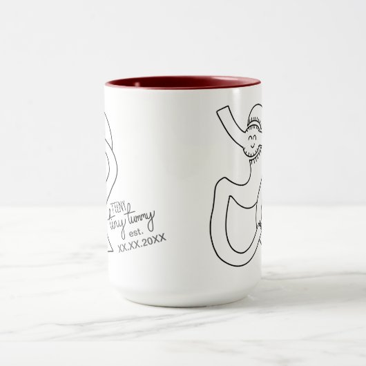 Aangepaste maag bypass bariatrische chirurgische d mok (Midden)