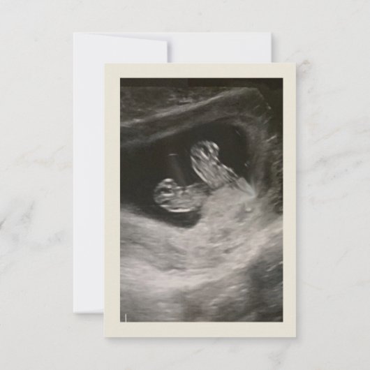 Aankondiging baby Twins (Achterkant)