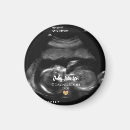 Aankondiging van komst baby met echoscopie magneet