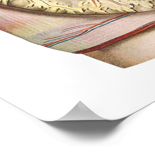 Abdominaal vet / obesitas poster (Hoek)