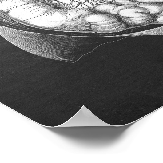 Abdominale aorta-anatomie poster (Hoek)