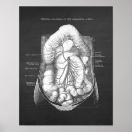 Abdominale aorta-anatomie poster