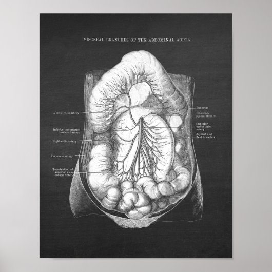 Abdominale aorta-anatomie poster (Voorkant)