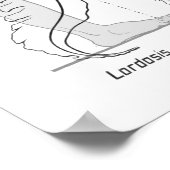 Abnormale Curves of the Spine Poster Chiropractic (Hoek)