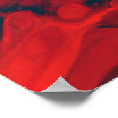 ABSTRACT BLOEDVEZEL POSTER (Hoek)