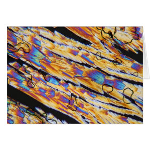 Acetylsalicylzuur onder microscoop