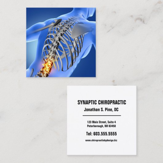 Achterpijn Fotografisch vierkant Chiropractisch Vierkante Visitekaartje (Voorkant / Achterkant)