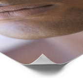 Acupunctie. Acupuncturist die een naald inbrengt Poster (Hoek)